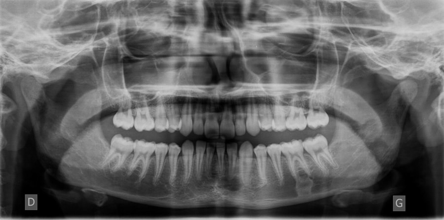 ortho